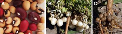 Prospects of rhizobial inoculant technology on Bambara groundnut crop production and growth